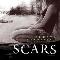 Scars Audiobook, by Cheryl Rainfield