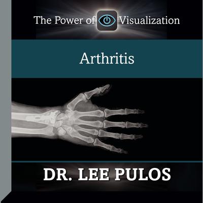 Arthritis Audiobook, by Lee Pulos