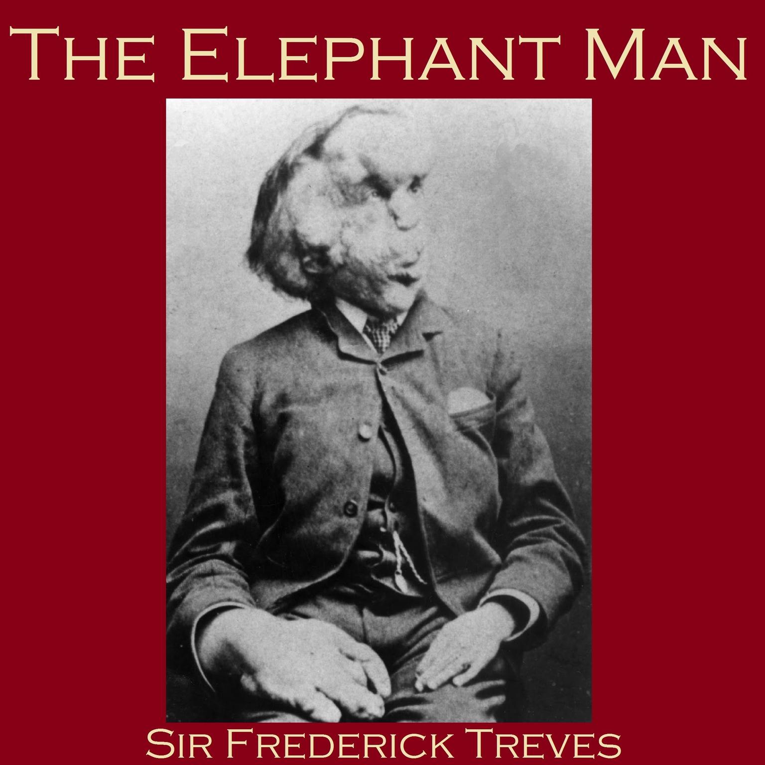 The Elephant Man Audiobook, by Frederick Treves