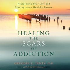 Healing the Scars of Addiction: Reclaiming Your Life and Moving into a Healthy Future Audiobook, by Gregory L. Jantz