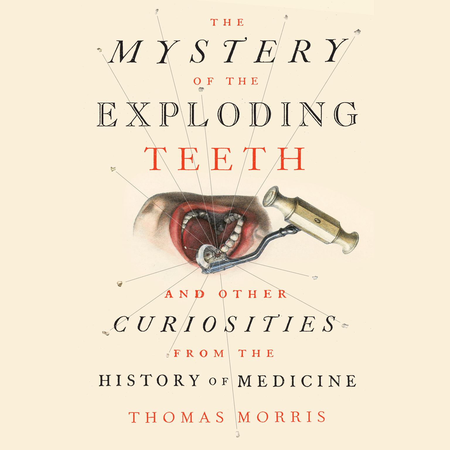 The Mystery of the Exploding Teeth: And Other Curiosities from the History of Medicine Audiobook, by Thomas Morris
