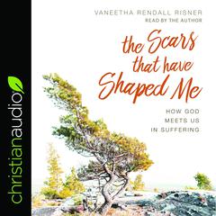 Scars That Have Shaped Me: How God Meets Us in Suffering Audiobook, by Vaneetha Rendall Risner