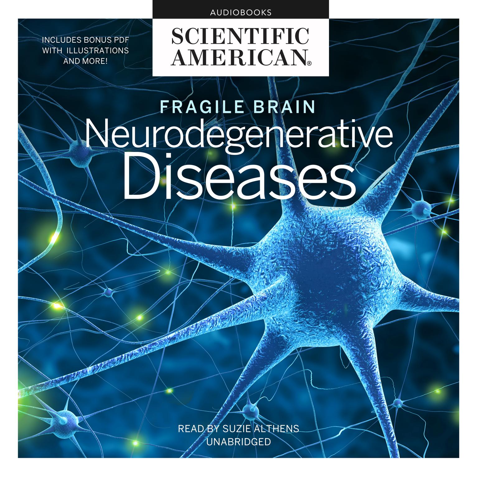 Fragile Brain: Neurodegenerative Diseases Audiobook, by Scientific American