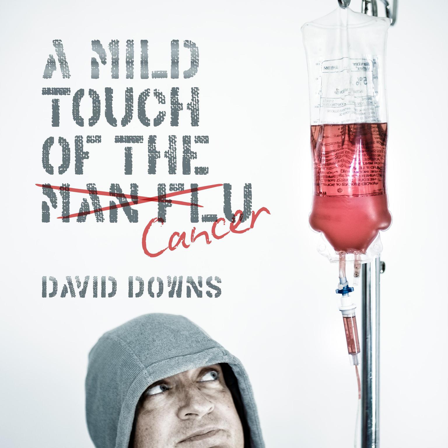 A Mild Touch of the Cancer (Abridged) Audiobook, by David Downs