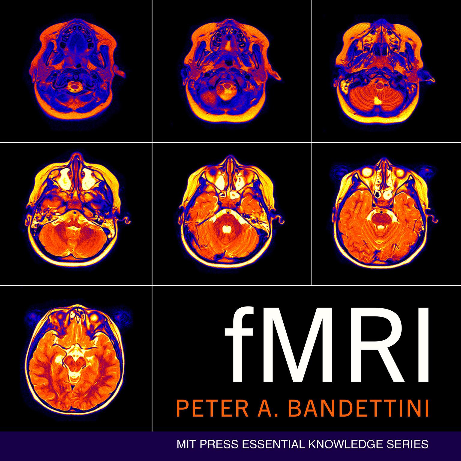 fMRI Audiobook, by Peter A. Bandettini