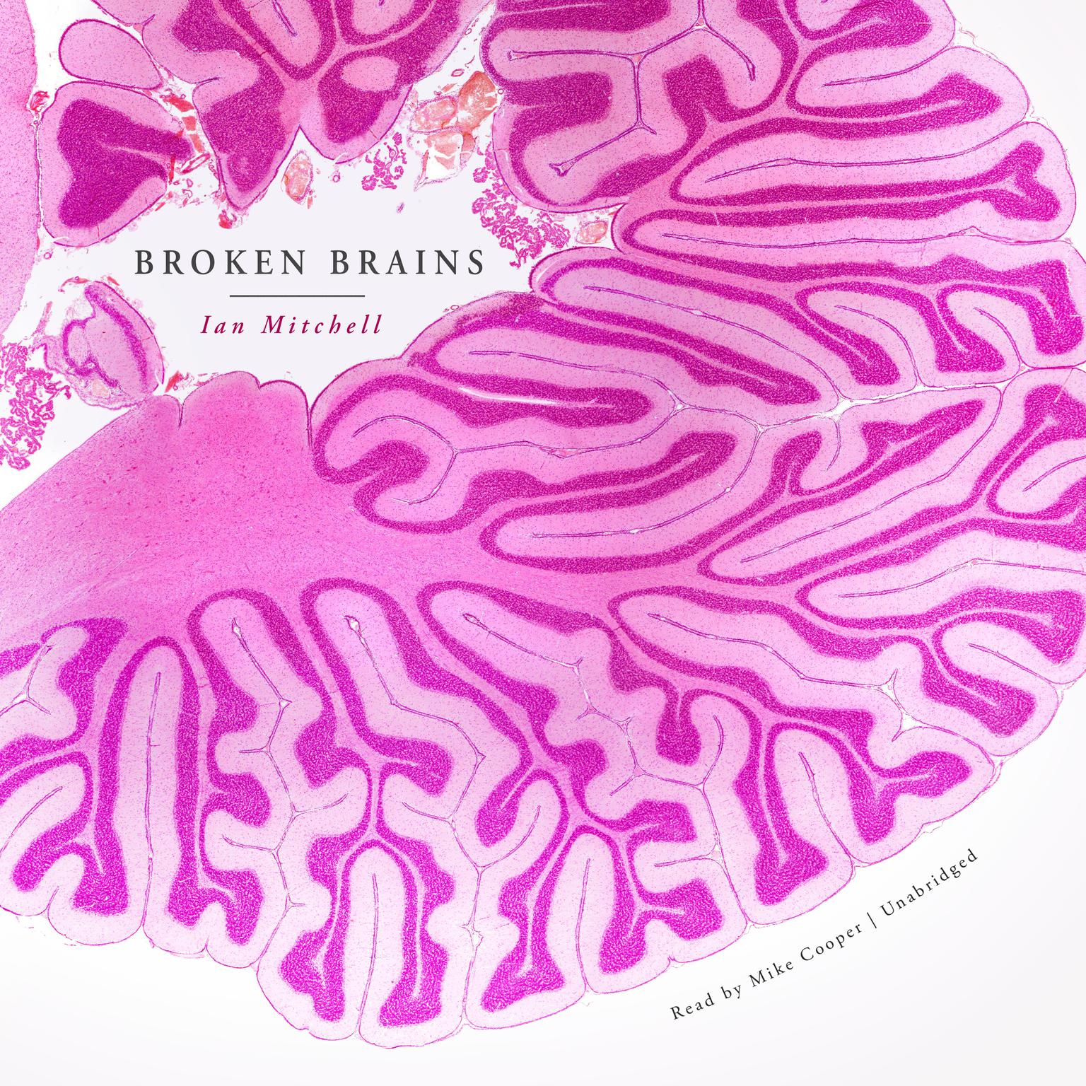 Broken Brains Audiobook, by Ian Mitchell