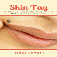 Skin Tag : Natural DIY Methods of removing Mole, Wart and Skin Tag Audiobook, by Singe Lamett