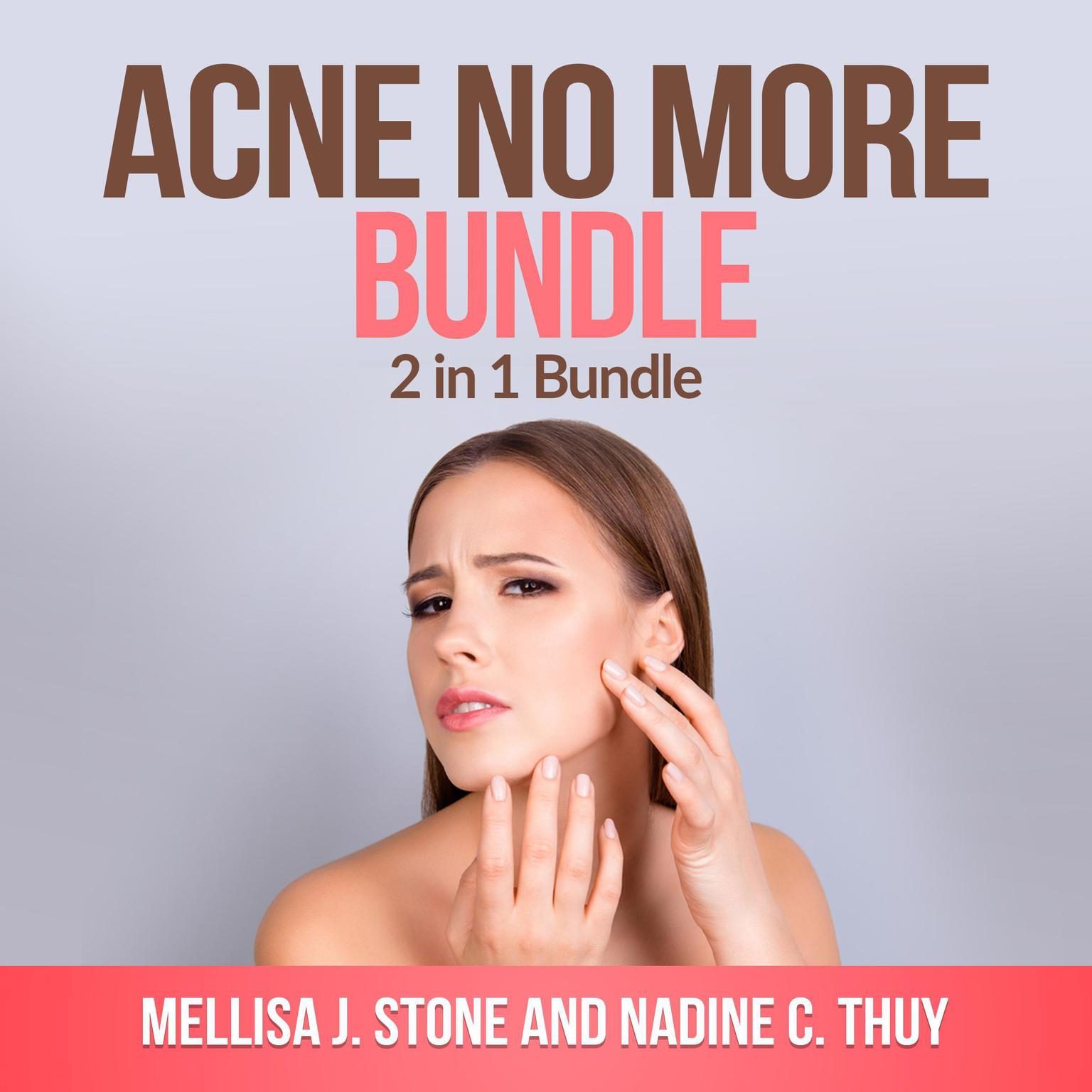 Acne no more Bundle: 2 in 1 Bundle, Acne, Acne Treatment for Teens Audiobook, by Mellisa J. Stone
