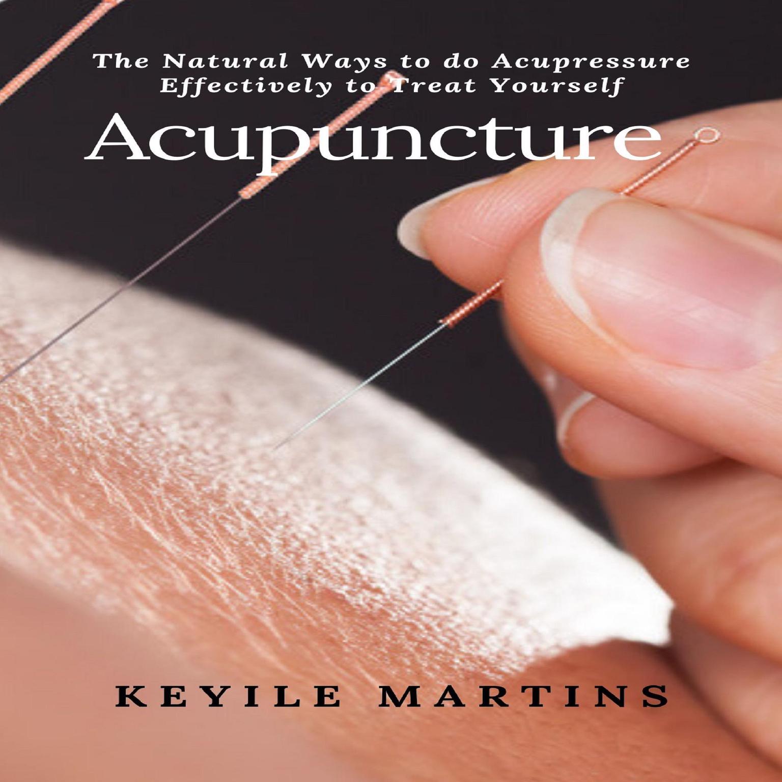 Acupuncture: The Natural Ways to Do Acupressure Effectively to Treat Yourself Audiobook, by Keyile Martins