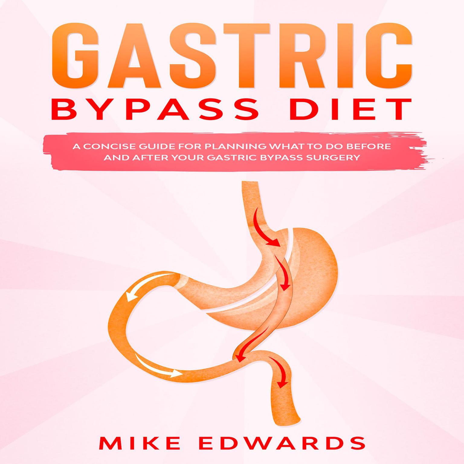 Gastric Bypass Diet: A Concise Guide for Planning What to Do Before and After your Gastric Bypass Surgery Audiobook, by Mike Edwards