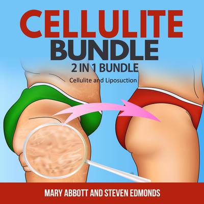Cellulite Bundle:: 2 in 1 Bundle, Cellulite, Liposuction Audiobook, by Mary Abbott