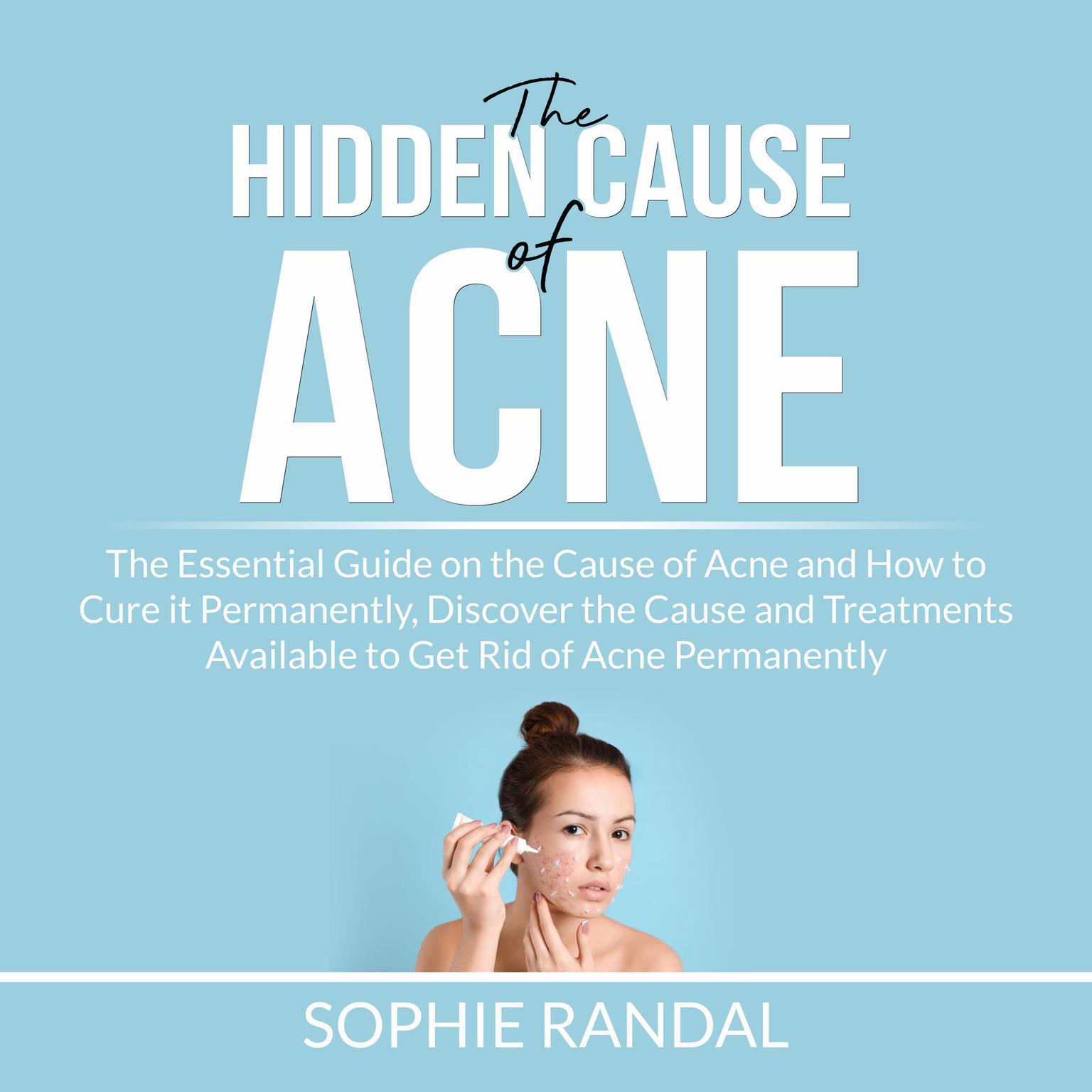 The Hidden Cause of Acne: the Essential Guide on the Cause of Acne and How to Cure it Permanently, Discover the Cause and Treatments Available to Get Rid of Acne Permanently Audiobook, by Sophie Randal