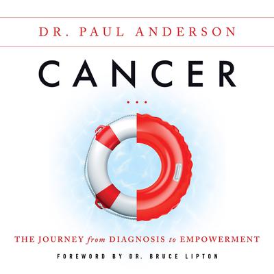 Cancer: The Journey from Diagnosis to Empowerment Audiobook, by Paul Anderson