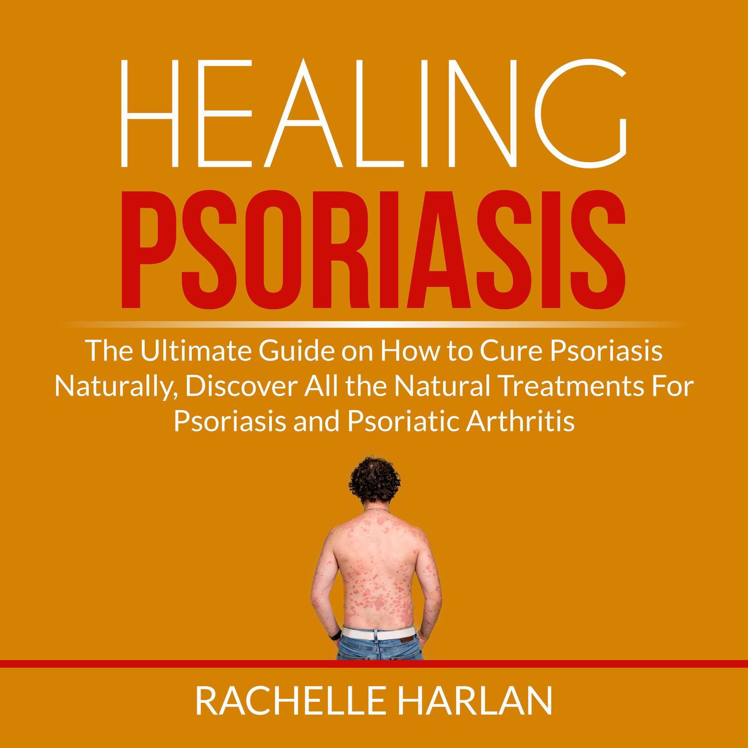 Healing Psoriasis: The Ultimate Guide on How to Cure Psoriasis Naturally, Discover All the Natural Treatments For Psoriasis and Psoriatic Arthritis Audiobook, by Rachelle Harlan