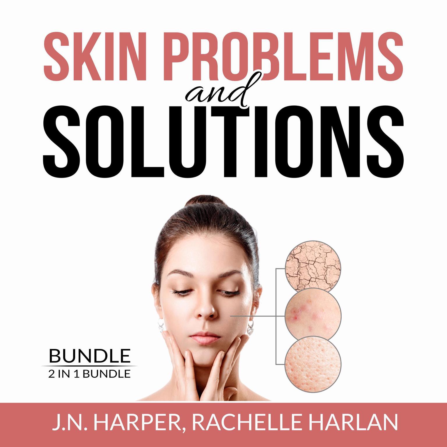 Skin Problems and Solutions Bundle:: 2 in 1 Bundle, Eczema Detox and Healing Psoriasis  Audiobook, by J.N Harper