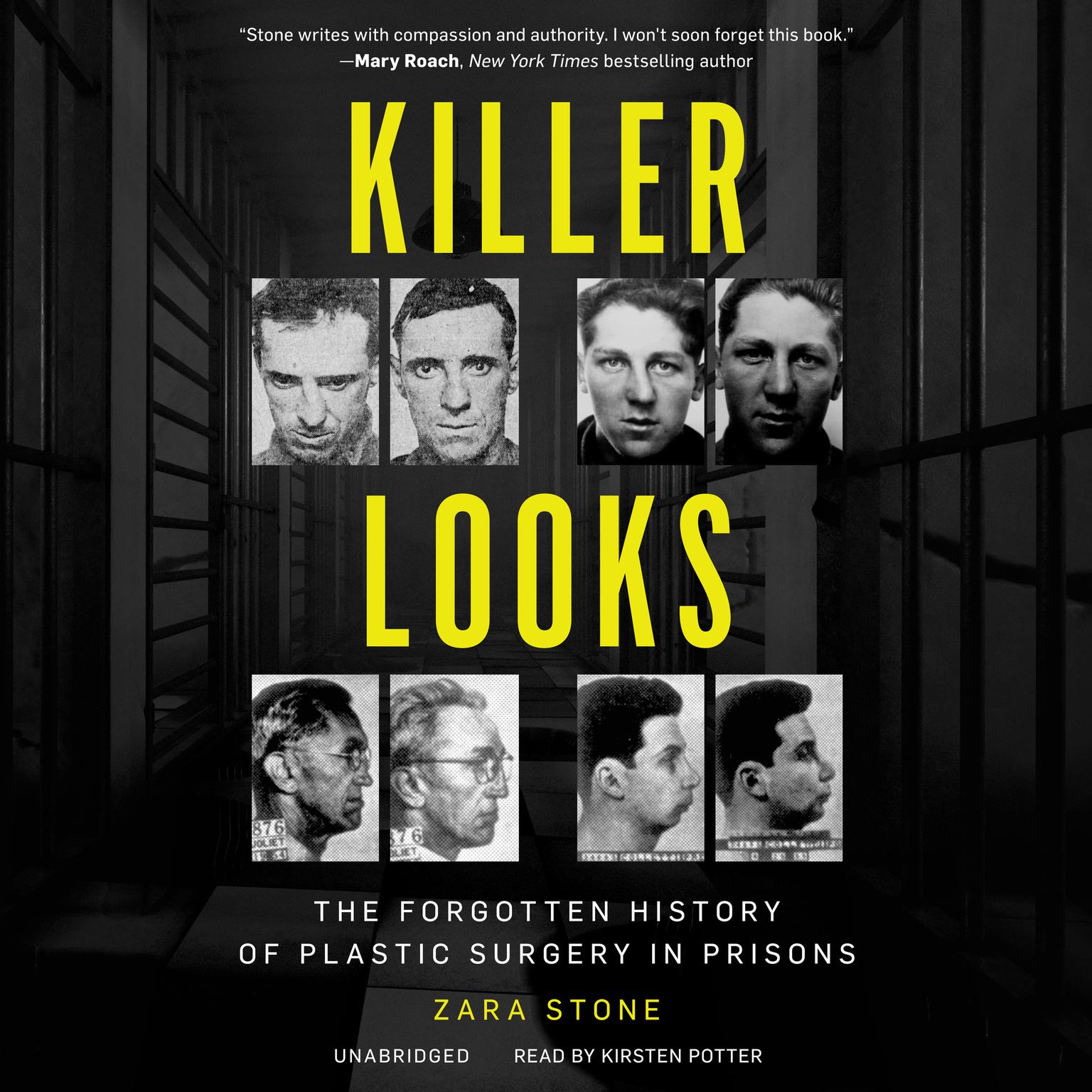 Killer Looks: The Forgotten History of Plastic Surgery in Prisons Audiobook, by Zara Stone
