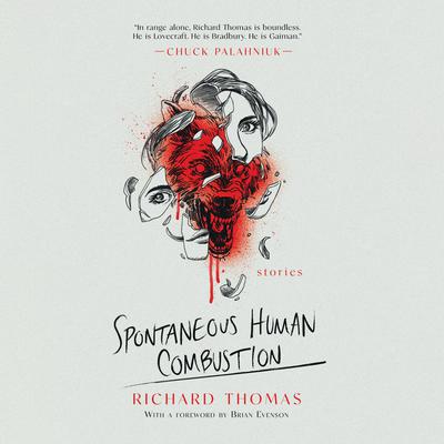 Spontaneous Human Combustion: Stories Audiobook, by Richard Thomas