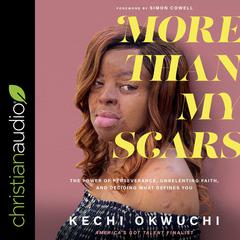 More Than My Scars: The Power of Perseverance, Unrelenting Faith, and Deciding What Defines You Audiobook, by Kechi Okwuchi