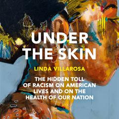 Under the Skin: The Hidden Toll of Racism on American Lives (Pulitzer Prize Finalist) Audiobook, by Linda Villarosa