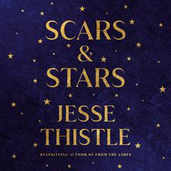 Scars and Stars Audiobook, by Jesse Thistle