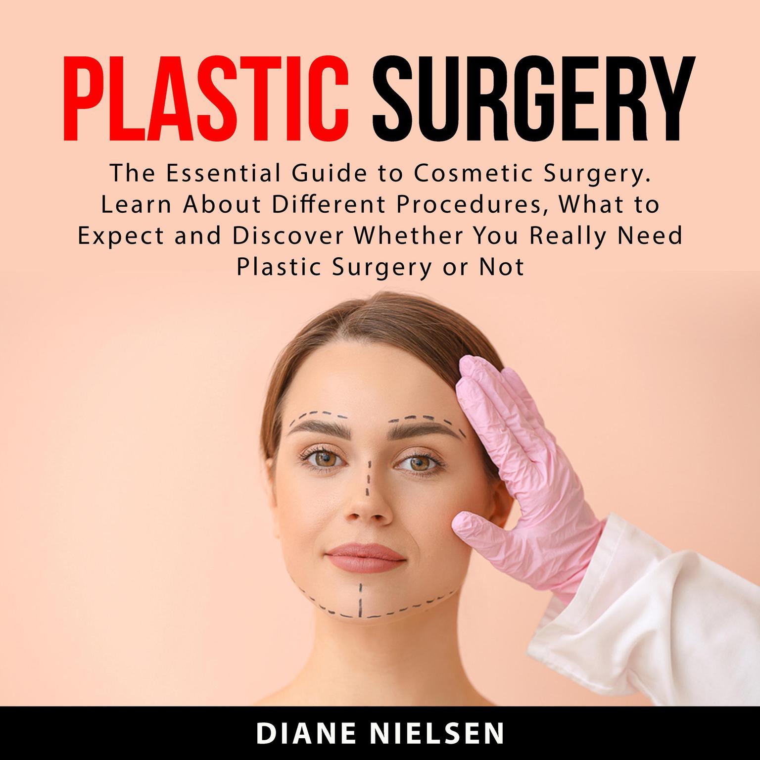 Plastic Surgery Audiobook, by Diane Nielsen