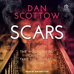 Scars Audiobook, by Dan Scottow