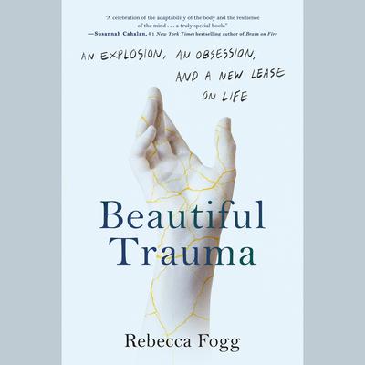 Beautiful Trauma: An Explosion, an Obsession, and a New Lease on Life Audiobook, by Rebecca Fogg