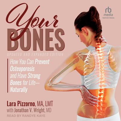 Your Bones: How You Can Prevent Osteoporosis and Have Strong Bones for Life—Naturally, Updated and Expanded Edition Audiobook, by Lara Pizzorno, MA, FMT