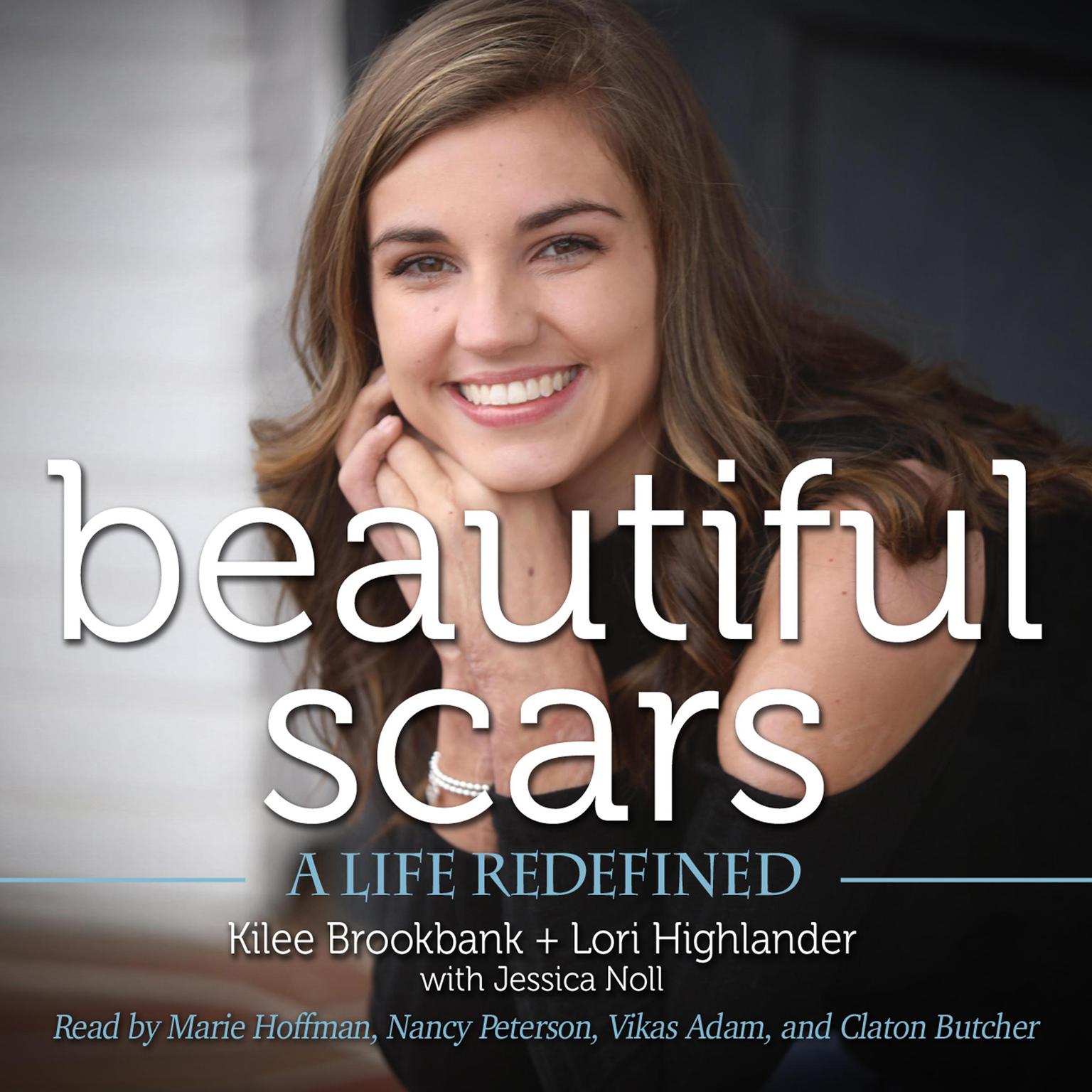 Beautiful Scars: A Life Redefined Audiobook, by Kilee Brookbank