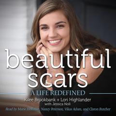 Beautiful Scars: A Life Redefined Audiobook, by Kilee Brookbank