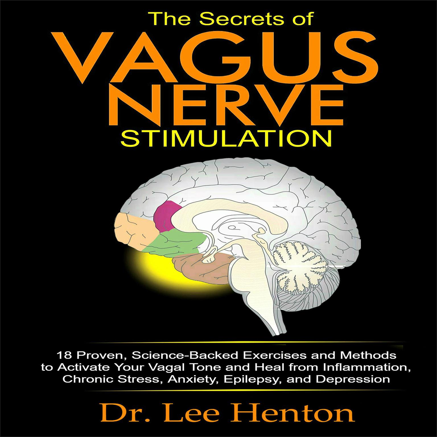 The Secrets of Vagus Nerve Stimulation (Abridged) Audiobook, by Lee Henton