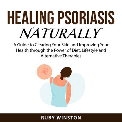 Healing Psoriasis Naturally Audiobook, by Ruby Winston