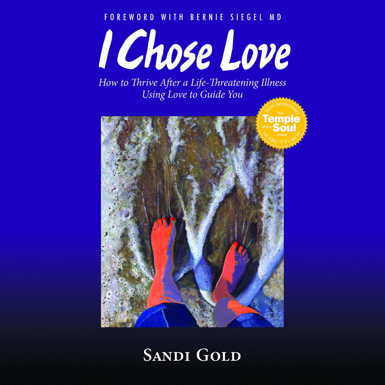 I Chose Love Audiobook, by Sandi Gold