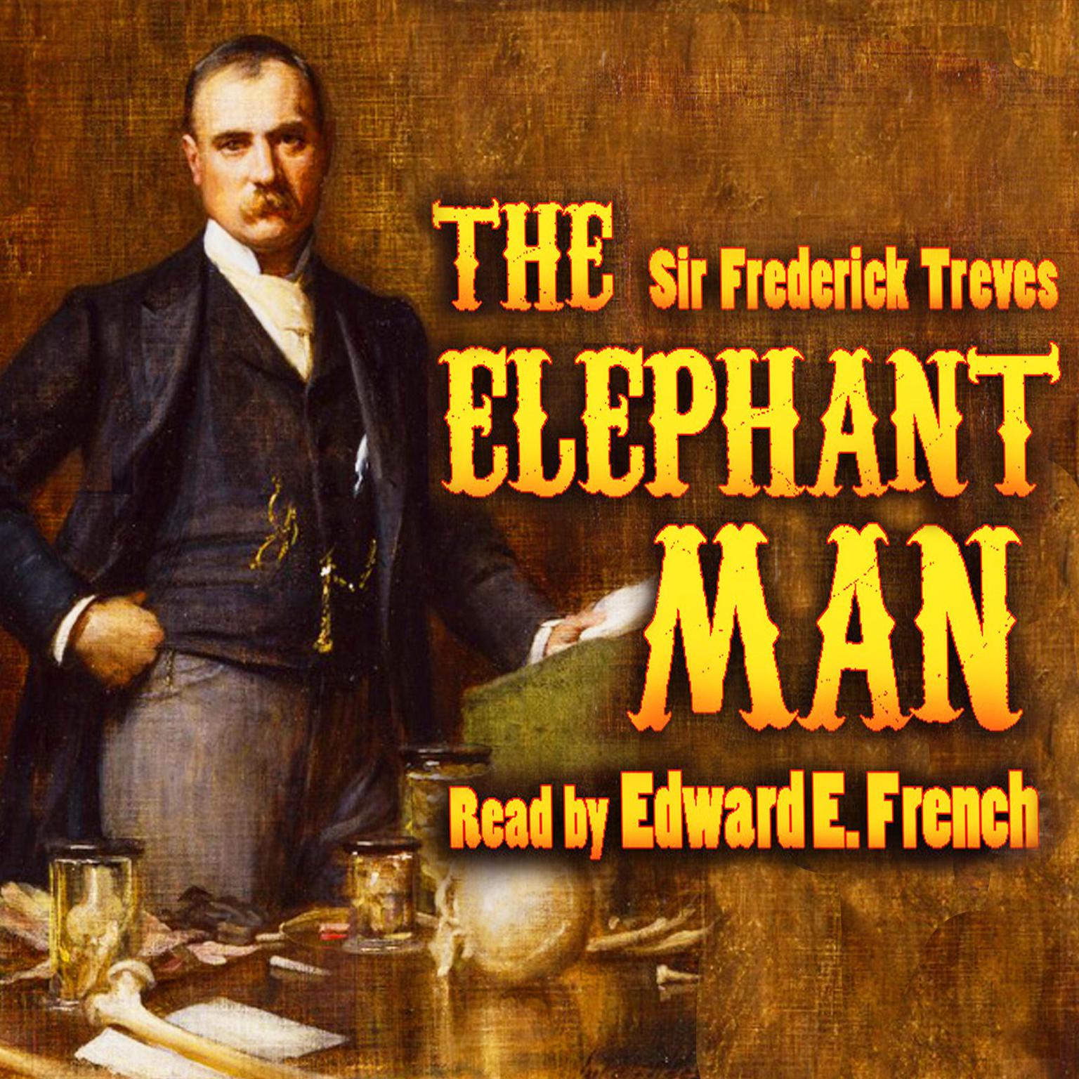 The Elephant Man Audiobook, by Frederick Treves