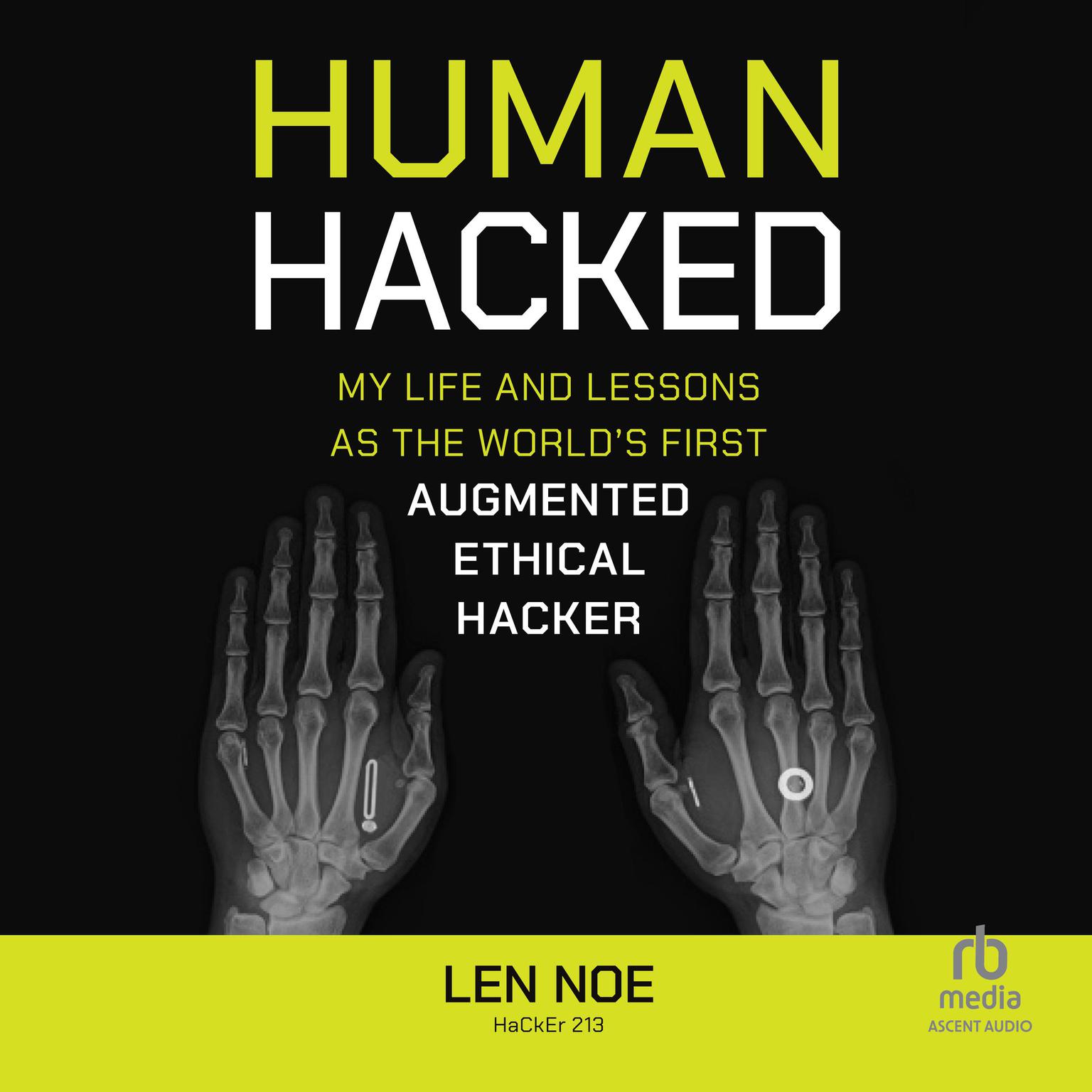 Human Hacked: My Life and Lessons as the Worlds First Augmented Ethical Hacker Audiobook, by Len Noe